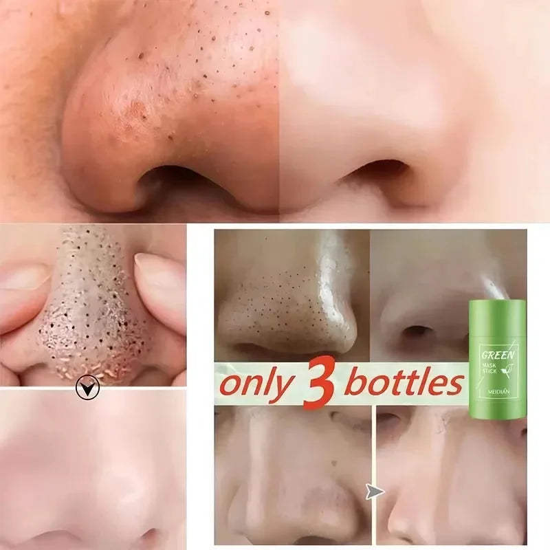 Green Tea Remove Blackhead Solid Mask Dispel Acne Blemish Cleansing Stick Mask Shrink Pores Tighten Whitening Skin Beauty Care