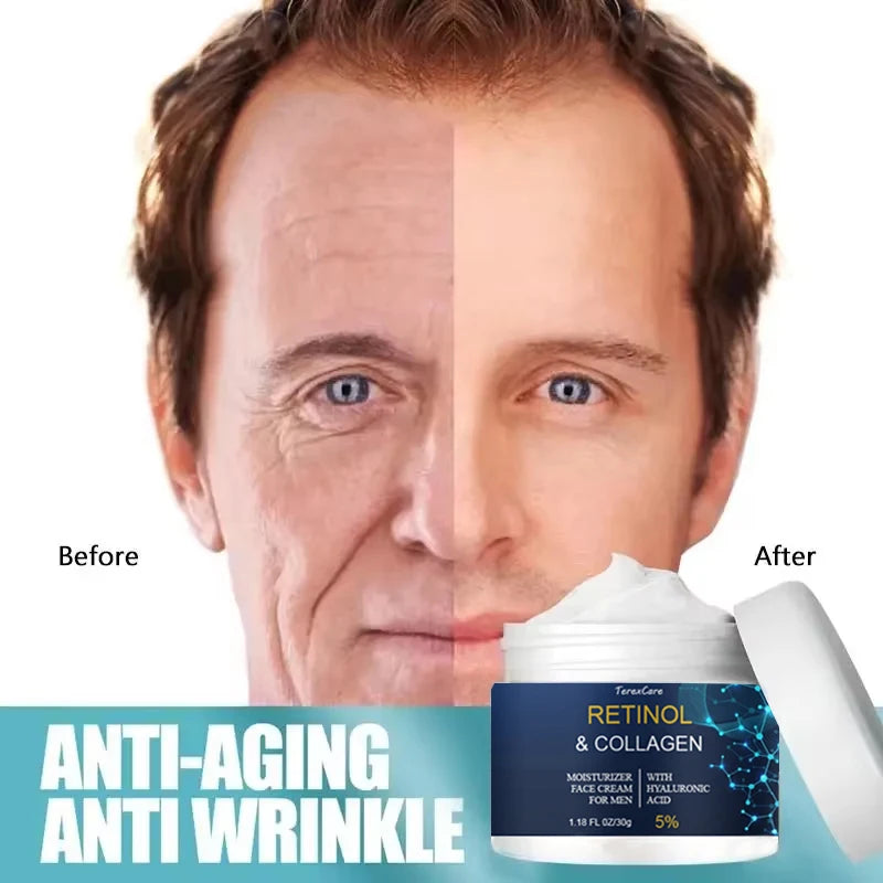 Wrinkle Cream For Men Remove Face Neck Wrinkle Firming Moisturizing Skin Retinol Collagen Face Cream Anti-aging Facial Treatment